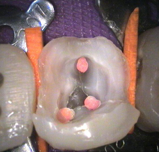 Endodoncie